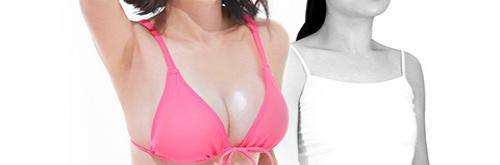 /upload/old_kmh/special_photo/public/breast%20augmentation_0.jpg