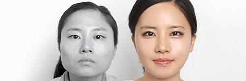 /upload/old_kmh/special_photo/public/facial%20contouring%20surgery_0.jpg